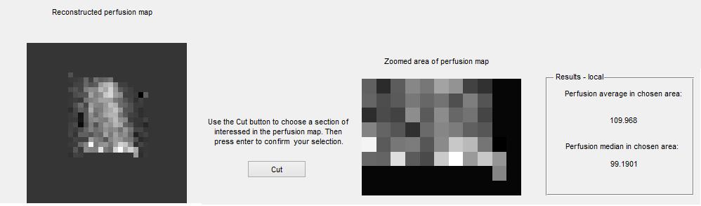 Obr. 25 - Zvětšený výřez z GUI: Vlevo - perfúzní mapa po zoomu. Vpravo - část perfúzní mapy vybraná pomocí tlačítka Cut a výsledky perfúze dané oblasti.