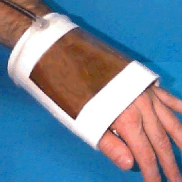 Jednozávitový selenoid (Single turn selenoid) Pro zobrazování extremit:
