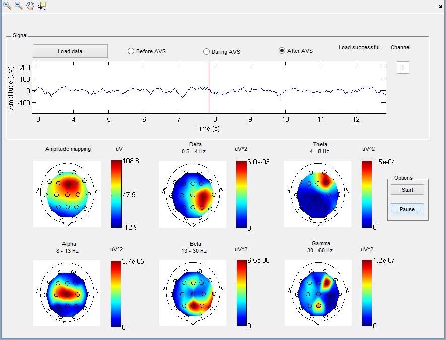 7. Uživatelské rozhraní GUI Pro realizaci programu v uživatelském prostředí byl použit program MATLAB (verze R2012b).