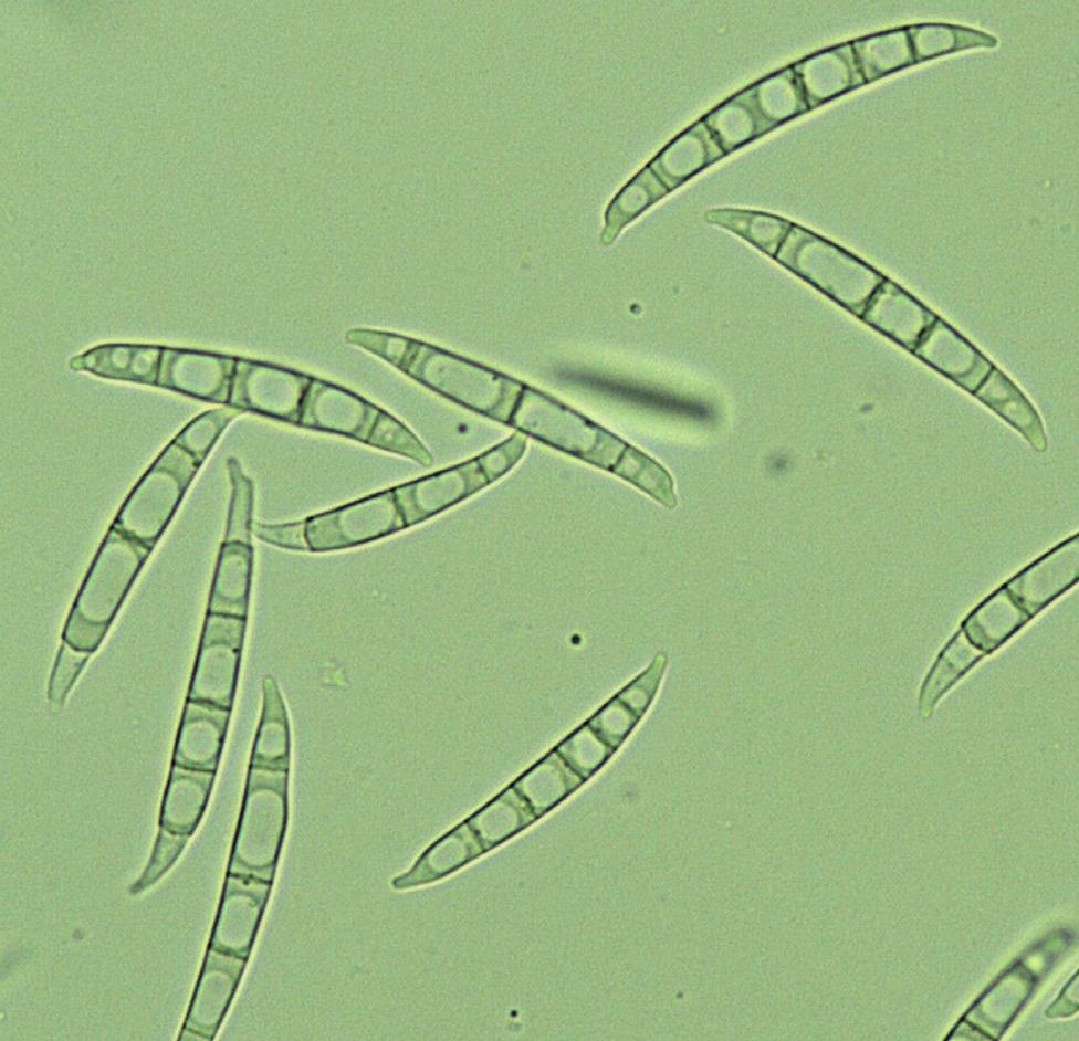 1/215 Choroby rostlin Obr. 4 Makrokonidie Fusarium graminearum V zrnu je napaden často již klíček, někdy je mycelium uvnitř endospermu.