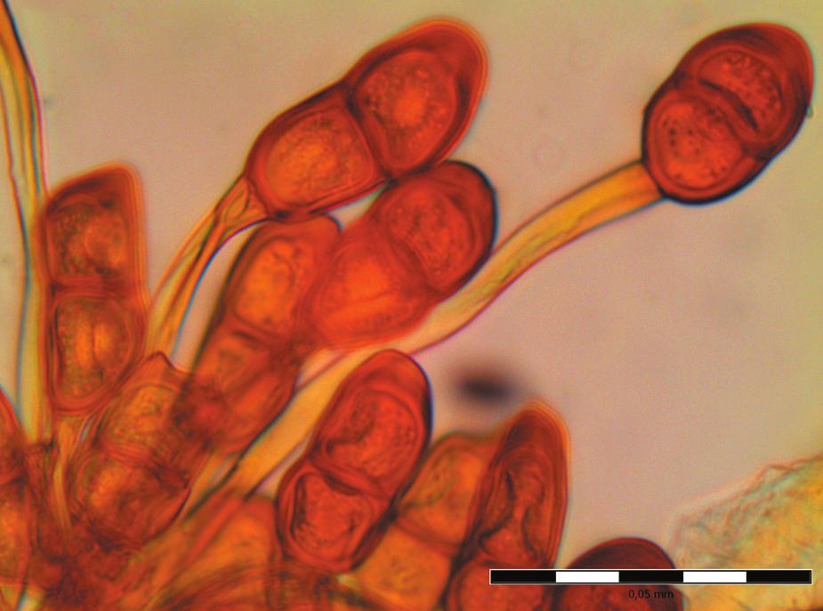 1/215 Choroby rostlin Obr. 7 Teliospory Puccinia sorghi jsou zřetelné nejčastěji až ve fázi začátku zrání. Pozdní typ infekce se projevuje nad palicemi odumíráním vrcholů rostlin.