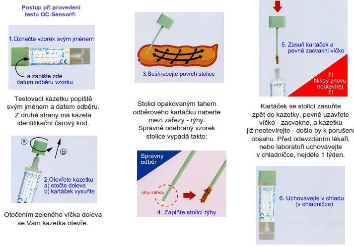 Příloha 3: Pokyny pro pacienta: Průkaz okultního krvácení ve stolici (OC ensor test) Vážená paní, vážený pane, tímto testem může být prokázáno okultní, tedy nepatrné množství krve ve stolici.