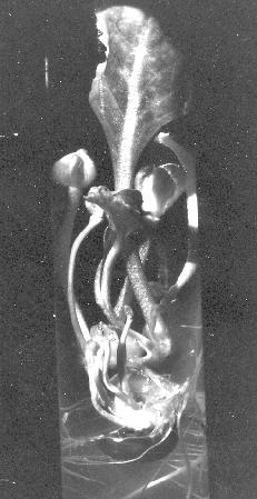 Vitrifikace vyjadřuje abnormality