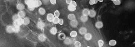 Embryokultury- kultury embryí in vitro = kultivace