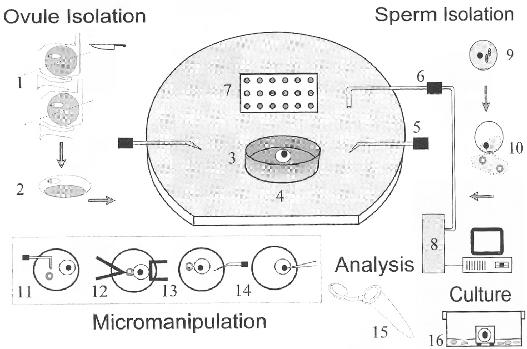 In vitro fertilizace pyl.