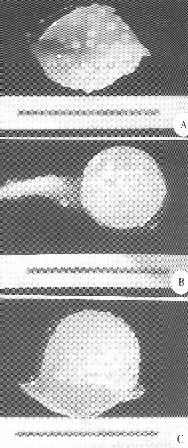 Somatická embryogeneze a suspenzní kultury Buněčná suspenze = převedeme kalus do tekutého média a provzdušňujeme (kontakt buněk a shluků buněk s médiem) auxin (2,4-D) Využití: vzniká