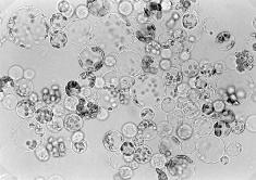 I.Takebe, G. Melchers, C. Labib-rostliny z mezofylových protoplastů tabáku 1972 P. S. Carlsona kol.