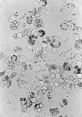 protoplastů Fúze protoplastů