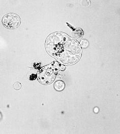 Protoplastové kultury- fúze protoplastů Přenos jaderné a cytoplazmatické