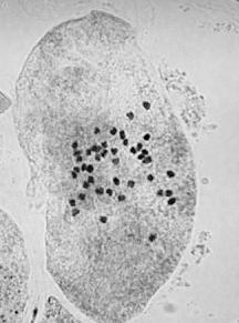 Protoplastové kultury- fúze protoplastů Identifikace somatických hybridů: