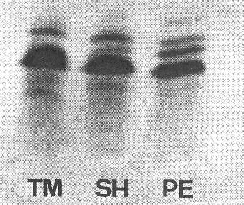 sekvencí (DNA-DNA hybridizace, RFLP analýzy) Biochemicky (izoenzymy, dílčí