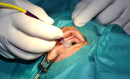 3/18 Kliniky v Krajské zdravotní Oční klinika společnosti, postupně se habilitoval na docenta a stal se profesorem očního lékařství. MUDr.