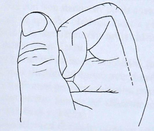 Flexory prstů, ruky a zápěstí se nachází na palmární straně horní končetiny a podrobněji byly popsány v kapitole Svaly zápěstí a ruky.