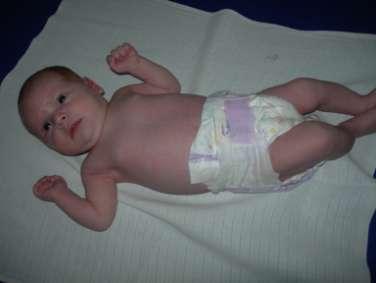 4.3. Třetí vyšetřované dítě: Andrea (narozena 15. 3. 2010) Anamnéza: narozena ve 40. týdnu gravidity, porod bez komplikací. Porodní váha 3250g, porodní délka 46 cm.