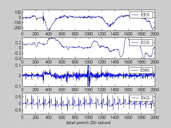 Polysomnografie - experiment EEG C4-A1 EOG oční pohyby (svod