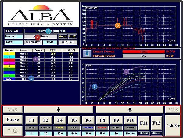 Obrázek 10: Počítačový kontrolní systém ALBA ON 4000 [20] 4.4 Statistické zpracování dat Statistická analýza byla provedena z dat poskytnutých Nemocnicí Na Bulovce.