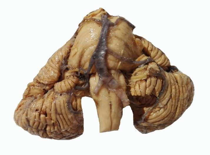 Mozkový kmen ventrální strana plastinovaný preparát 2