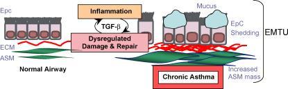 Remodelace dýchacích cest u astmatu Key: ASM, airway smooth muscle; ECM, extracellular matrix; EMTU, epithelial to mesenchymal trophic unit;