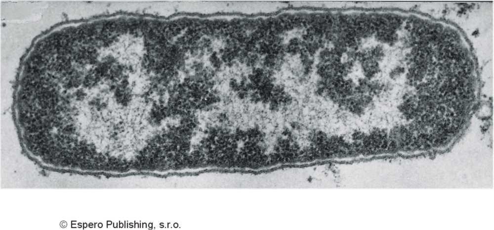 DNA, plazmidy 4 5 mil.