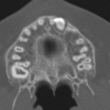 11 Radiologická dokumentace dvanáctileté