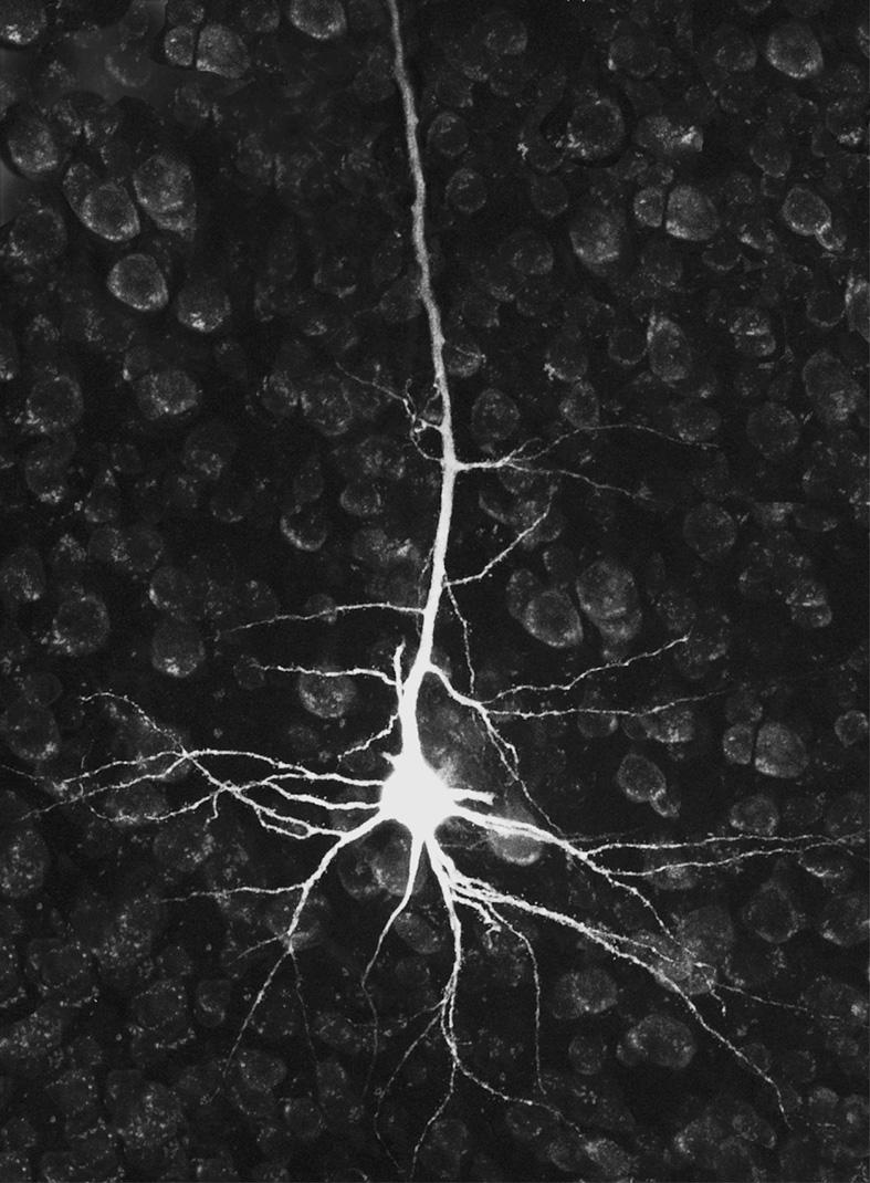 Co jsou umělé neuronové sítě Umělý neuron je hrubou matematickou aproximací biologického neuronu.