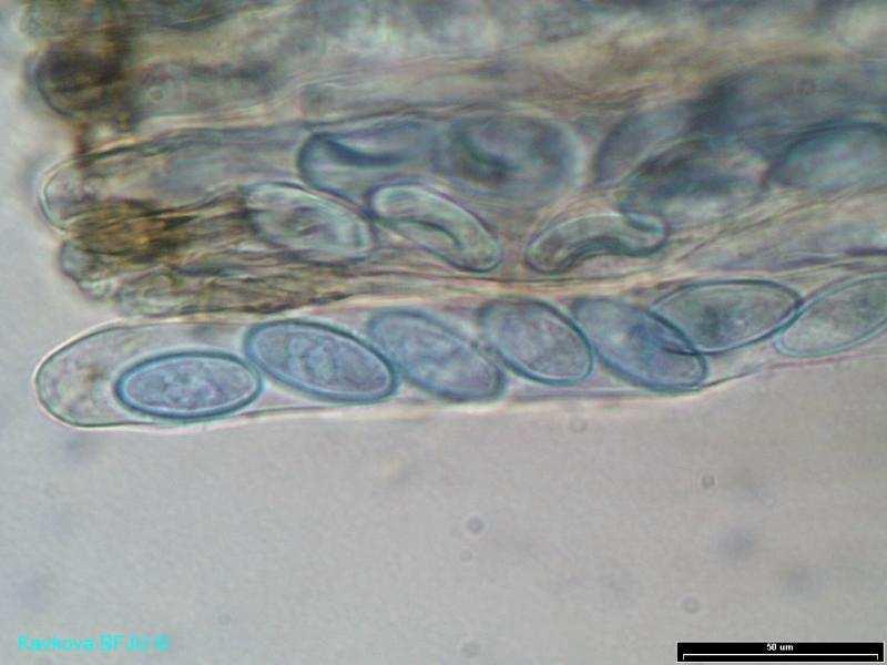 Regulace autonomními mechanismy (Eumycota) - endogenní chemické faktory u homo- i heterothalických druhů -