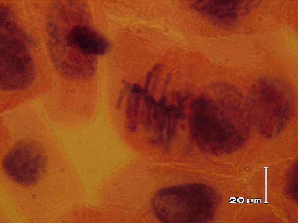 Metafáze Chromozom se napojí centromerou na vlákno dělícího vřeténka. Chromozomy jsou rozprostřeny v centrální rovníkové rovině b. Ch. jsou nejlépe pozorovatelné (počet, morfologie).