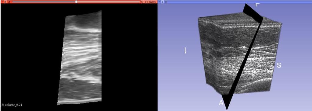 8 Záznamy pacientek 3D Rekonstrukce Výpočet a zobrazení 3D rekonstrukce pro vybrané datové sekvence proběhne automaticky, s využitím programové dávky, která zavolá programy VolumeReconstructor