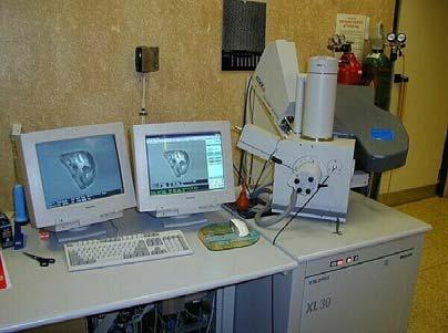 Proto v další fázi byl vzorek pozorován na rastrovacím elektronovém mikroskopu Phillips XL-30 s cílem upřesnit