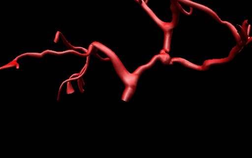 Diagnostické simulace Simulace krevního průtoku Virtuální