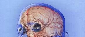 Visualizacepro diagnostiku Maximum Intensity