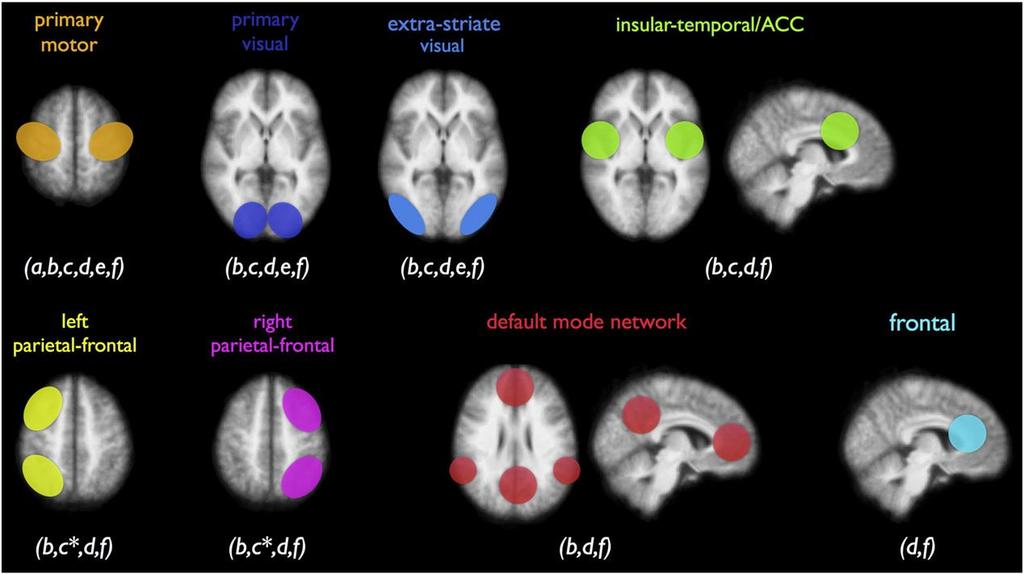 Funkční MRI: klidové mozkové sítě