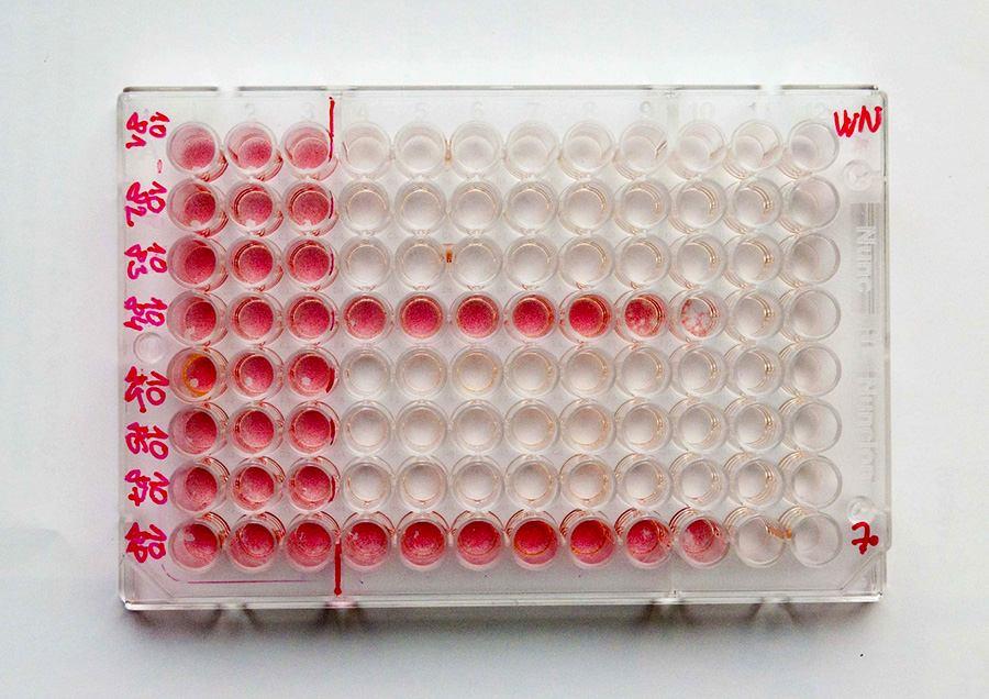 Virusneutralizační test (VNT) 4