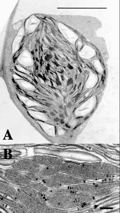 Fig. 3. Transmission electron micrographs of chloroplasts in hornworts. A. Leiosporoceros dussii (Steph.