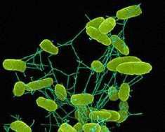 [52] Gramnegativní nefermentující bakterie (běžně se nalézají ve vodním prostředí, ale mohou se chovat jako potenciální patogeny, zejména u osob s oslabenou imunitou [52] o Pseudomonas, Legionella