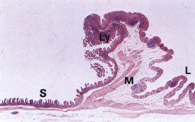 Podsliznice tenkého střeva dvanáctník glandulae submucosae duodenales Brunneri tuboalveolární mucinózní