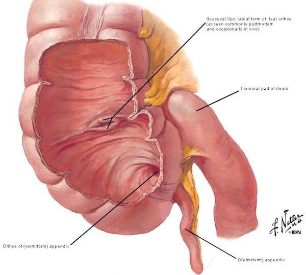 ostium ileale caeci
