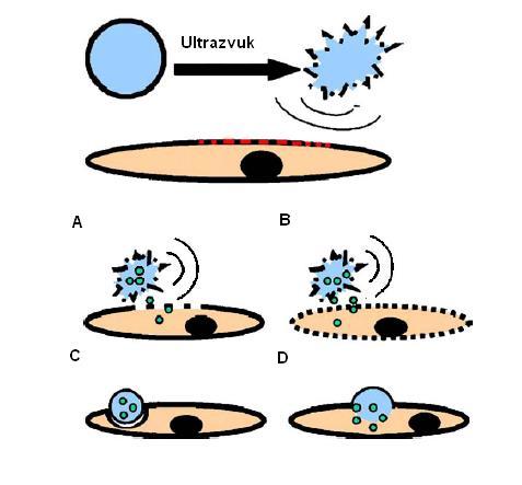 Obr. 3: Destrukce ultrazvukem a distribuce léčiv pomocí mikrobublin: A) přechodnými