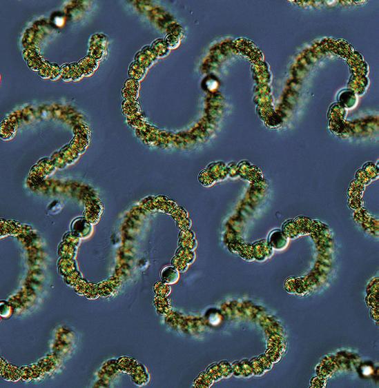 Coiled filaments of planktonic cyanobacterium Dolichospermum.