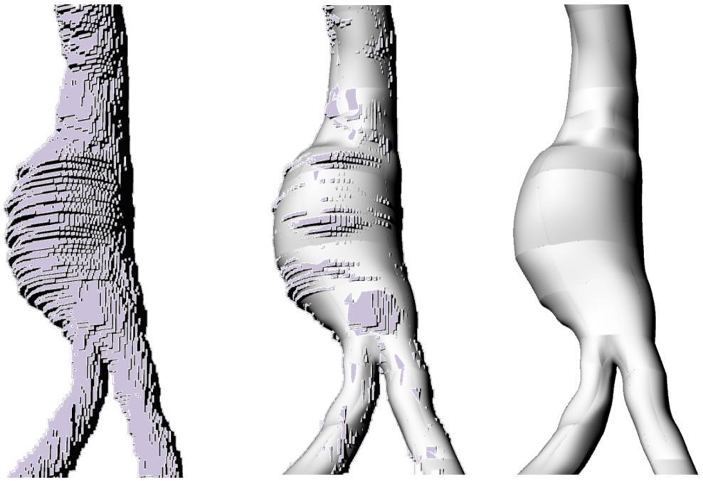 Objemová tetrahedrová výpočetní síť byla vygenerována v programu ANSYS Meshing, jednom z nástrojů prostředí ANSYS Workbench.