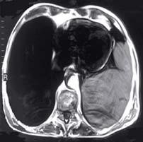 pneumologické