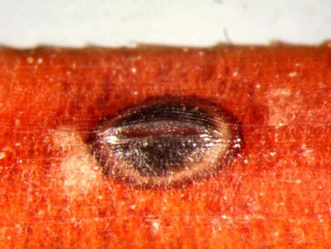 Hypoderma