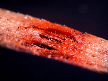 Mycosphaerella