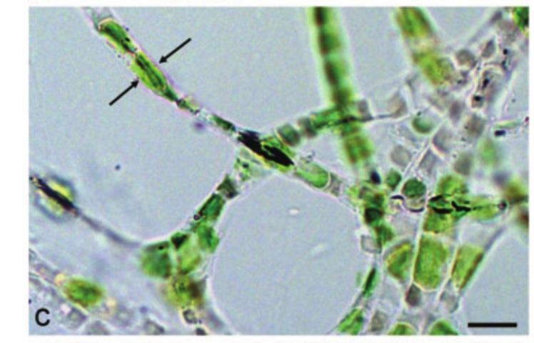 Obr. 5 (c) One-day desiccated (5% relative air humidity
