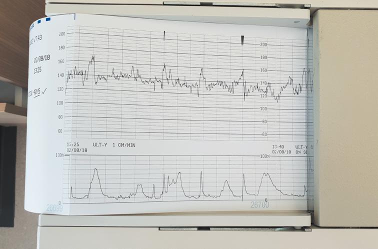 nekultivačními technikami, jakož i přítomnost intraamniálního zánětu stanovením IL-6 v plodové vodě.