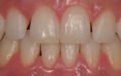 7887 970 www.micerium.