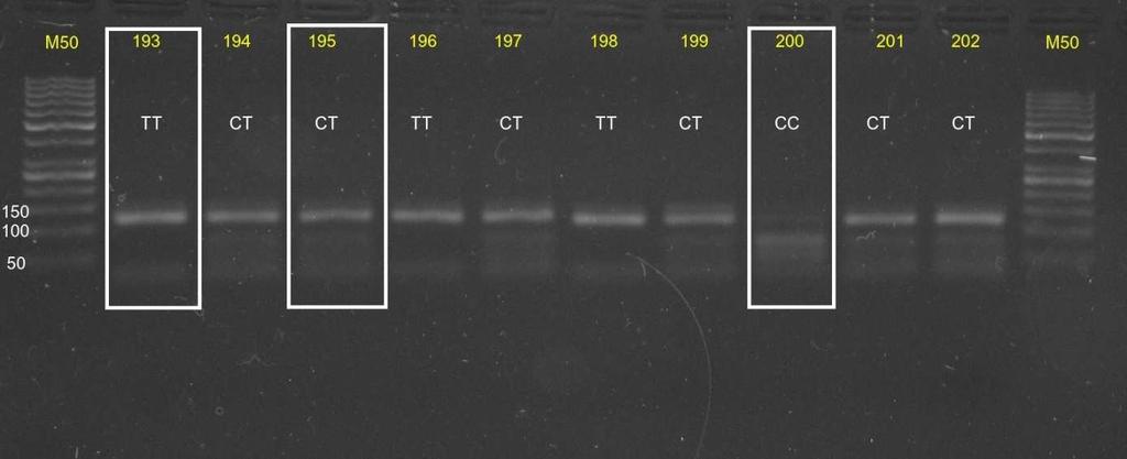Obrázek 10: Štěpený PCR produkt genu SCD1 restrikční endonukleázou SatI. Všechny tři genotypy jsou vyznačeny. 5.