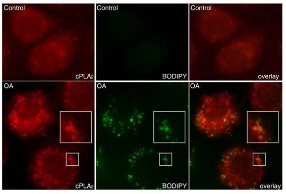 Kolokalizace LD s cpla2 a uvolňování AA u kolonových buněk po