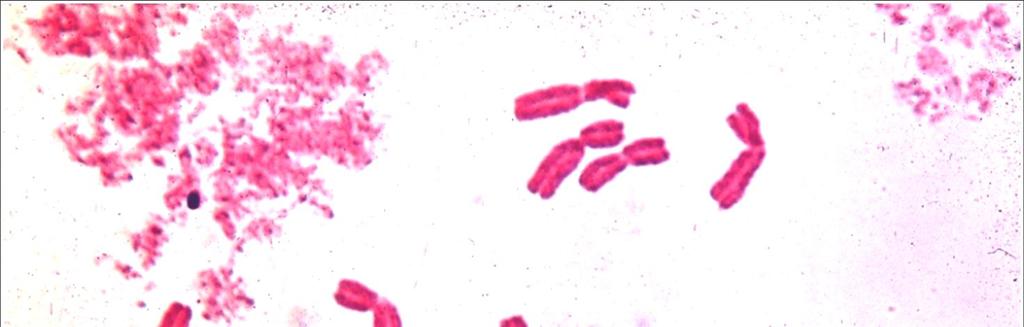 Chromozomy (Chromo-soma) 1882-1885: Flemming,