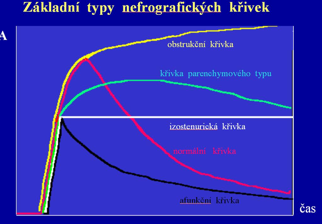 6.Dynamická scintigrafie ledvin Hodnocení : Tvar křivky nám poskytuje základní informaci. Sledujeme tzv.t max, což je doba, za kterou dosáhne křivka svého vrcholu.